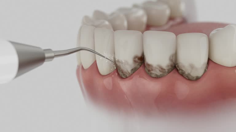 Reliable Dental contractor in Port Angeles, WA by Dentist Open Now